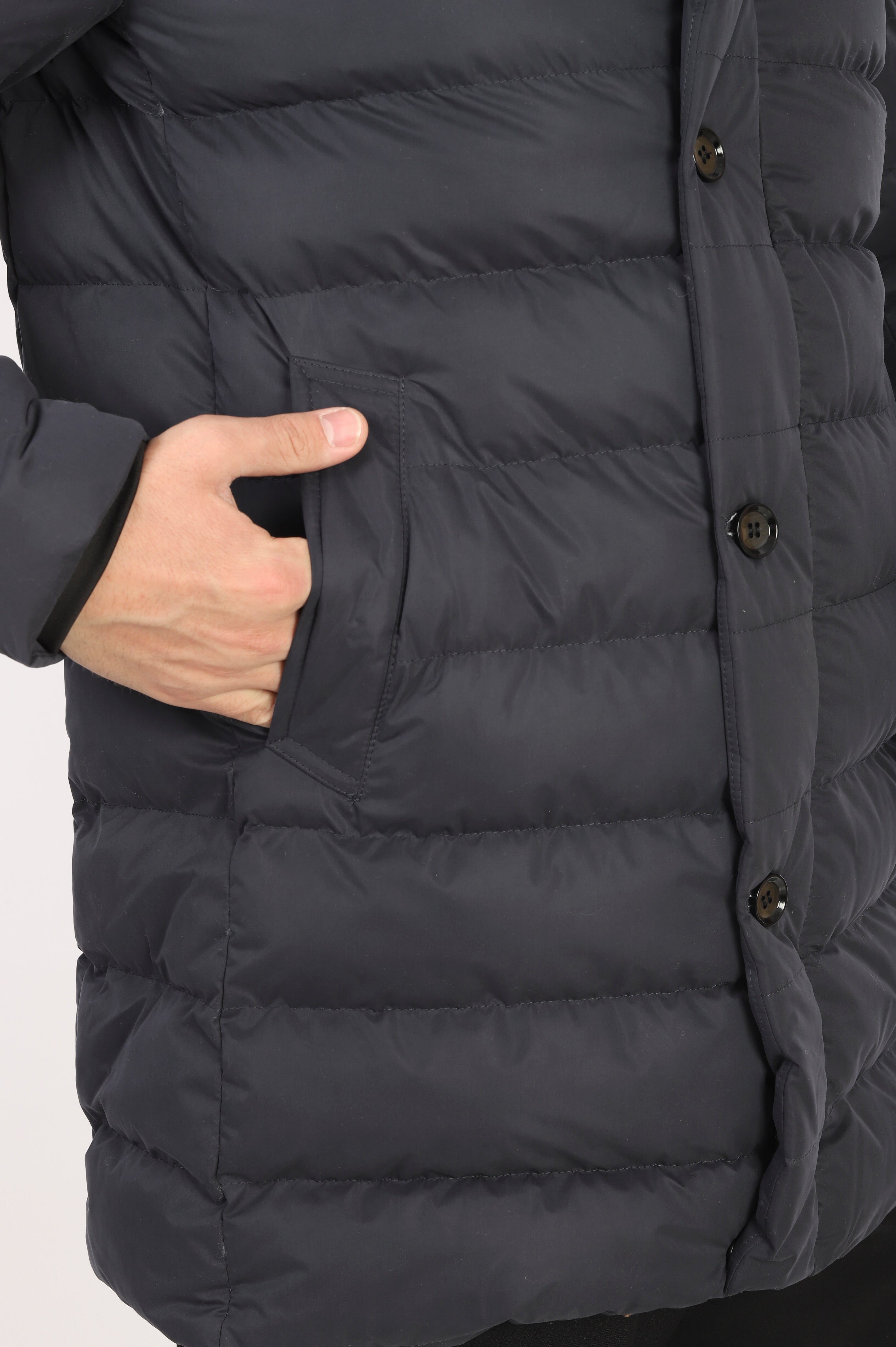 Çıkarılabilir Kapşonlu Düğmeli Uzun Şişme Mont